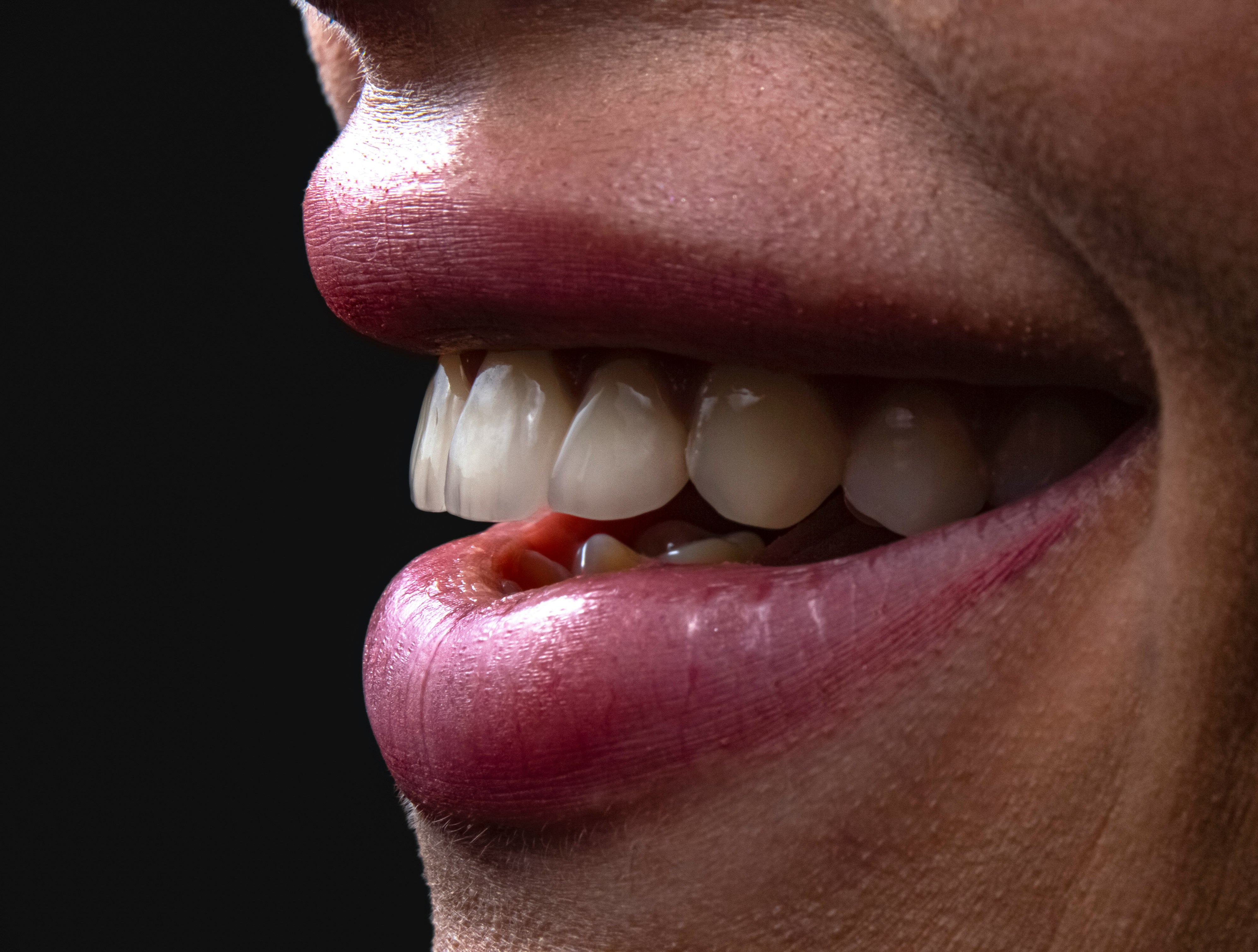 Cosmetic Dentistry at ORO-Care Dental Clinic