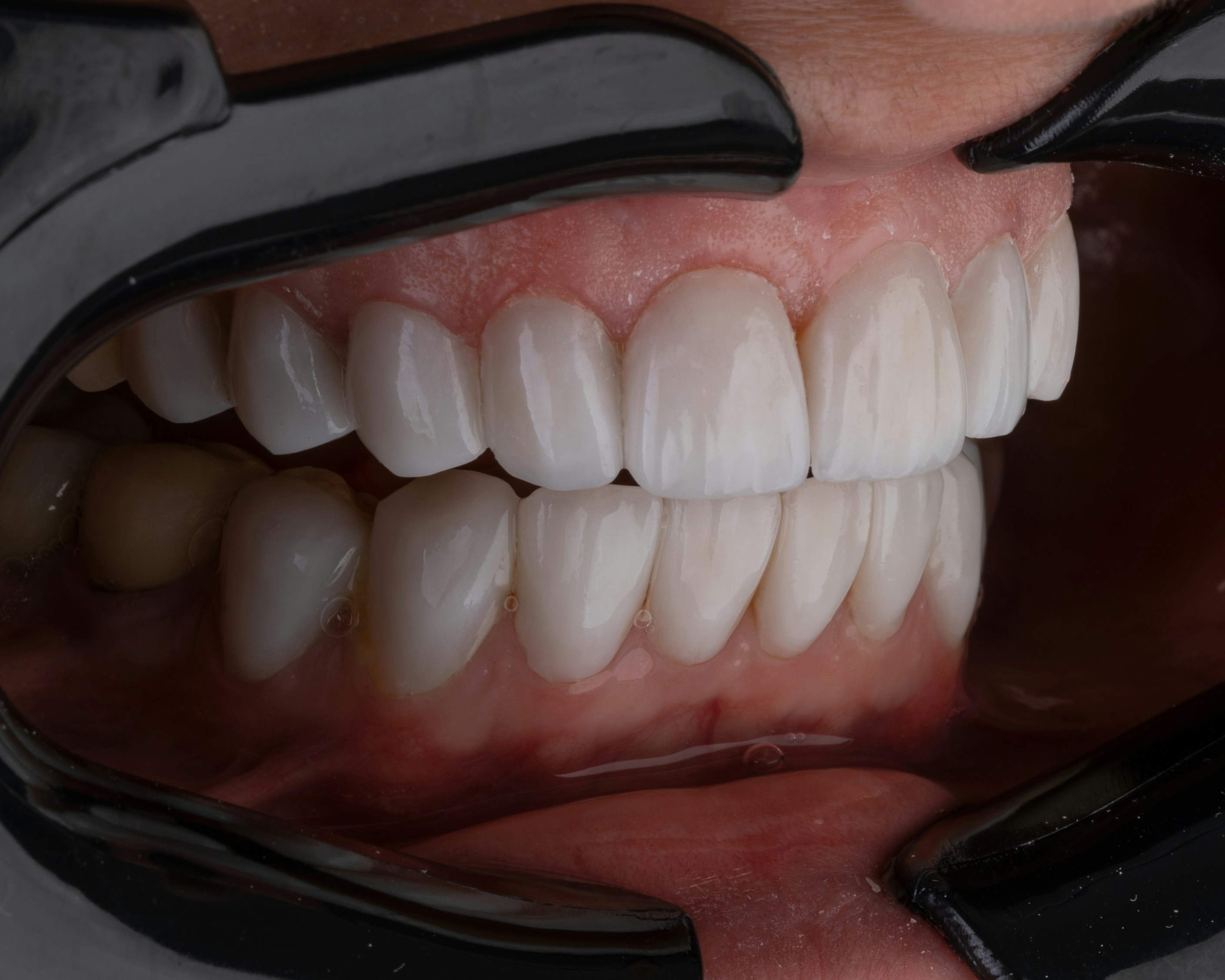 Oral and Maxillofacial Surgery at ORO-Care Dental Clinic