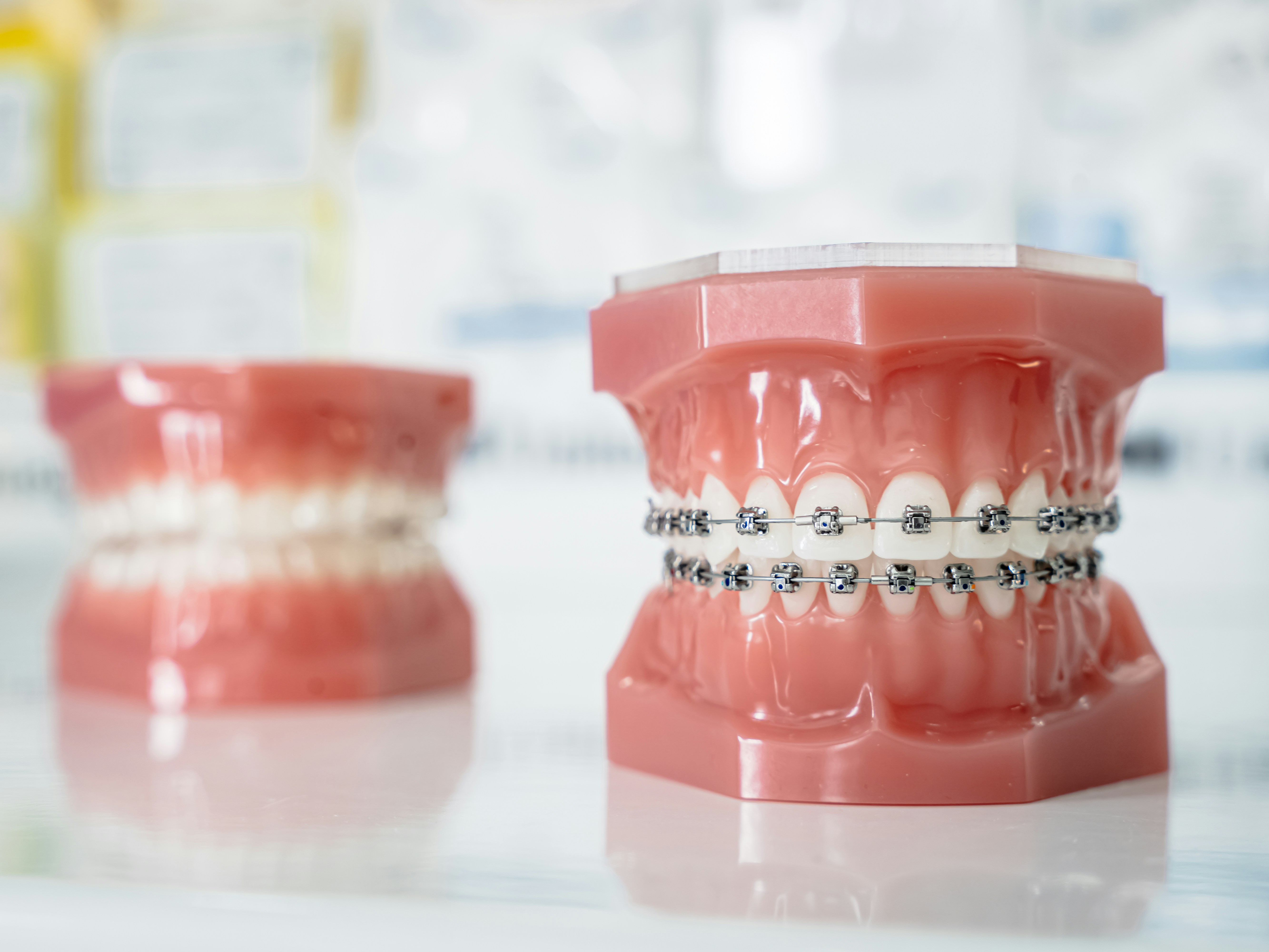 Orthodontic Braces at ORO-Care Dental Clinic